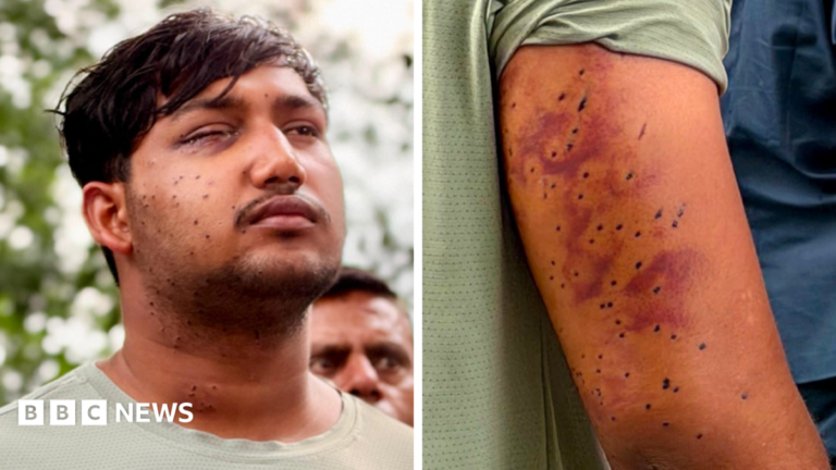Sahil Lochab's face and right arm which show the pellet gun wounds on his body