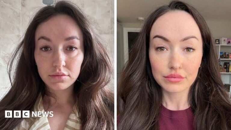 Ferritin face: Can you really diagnose low iron from your looks? Side-by-side photographs of Lucy facing the camera, with long dark hair, taken at different times.