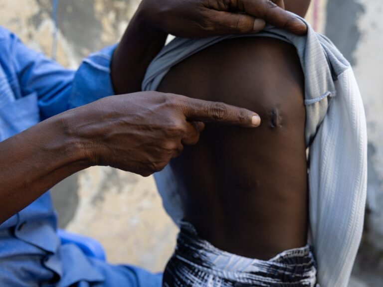 The human cost of surging US air strikes in Somalia | Conflict News The human cost of surging US air strikes in Somalia | Conflict News